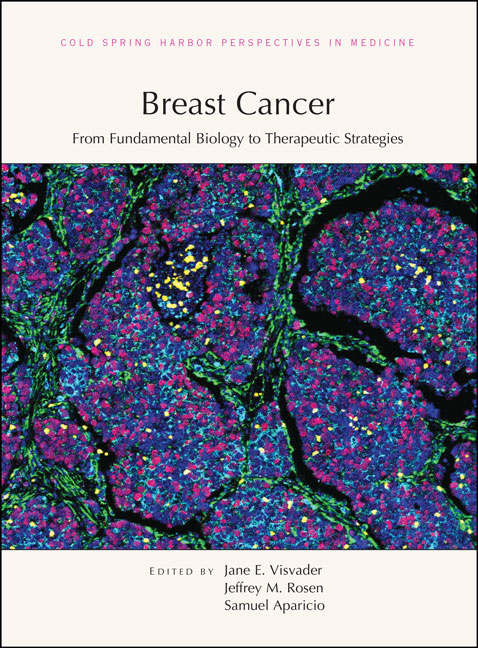 Breast Cancer: From Fundamental Biology to Therapeutic Strategies Cover Image
