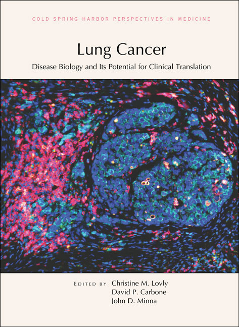 Lung Cancer: Disease Biology and Its Potential for Clinical Translation Cover Image